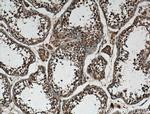 P3H1 Antibody in Immunohistochemistry (Paraffin) (IHC (P))