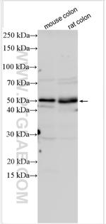 BMPR1B Antibody in Western Blot (WB)
