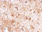 GFAP (Astrocyte and Neural Stem Cell Marker) Antibody in Immunohistochemistry (Paraffin) (IHC (P))