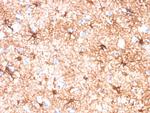 GFAP (Astrocyte and Neural Stem Cell Marker) Antibody in Immunohistochemistry (Paraffin) (IHC (P))