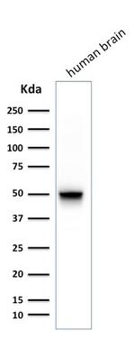 GFAP (Astrocyte and Neural Stem Cell Marker) Antibody in Western Blot (WB)