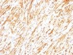 GFAP (Astrocyte and Neural Stem Cell Marker) Antibody in Immunohistochemistry (Paraffin) (IHC (P))
