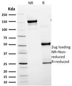 GFAP (Astrocyte and Neural Stem Cell Marker) Antibody in SDS-PAGE (SDS-PAGE)