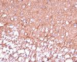 GFAP (Astrocyte and Neural Stem Cell Marker) Antibody in Immunohistochemistry (Paraffin) (IHC (P))