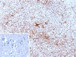 GFAP (Astrocyte and Neural Stem Cell Marker) Antibody in Immunohistochemistry (Paraffin) (IHC (P))