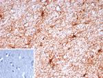 GFAP (Astrocyte and Neural Stem Cell Marker) Antibody in Immunohistochemistry (Paraffin) (IHC (P))