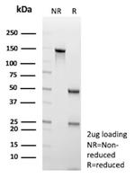 GFAP (Astrocyte and Neural Stem Cell Marker) Antibody in SDS-PAGE (SDS-PAGE)