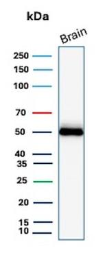 GFAP (Astrocyte and Neural Stem Cell Marker) Antibody in Western Blot (WB)