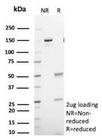 GFAP (Astrocyte and Neural Stem Cell Marker) Antibody in SDS-PAGE (SDS-PAGE)