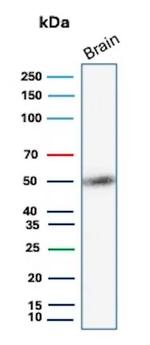 GFAP (Astrocyte and Neural Stem Cell Marker) Antibody in Western Blot (WB)
