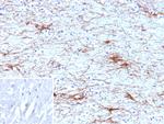 GFAP (Astrocyte and Neural Stem Cell Marker) Antibody in Immunohistochemistry (Paraffin) (IHC (P))