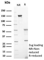 GFAP (Astrocyte and Neural Stem Cell Marker) Antibody in SDS-PAGE (SDS-PAGE)