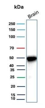 GFAP (Astrocyte and Neural Stem Cell Marker) Antibody in Western Blot (WB)