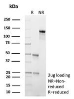 GFAP (Astrocyte and Neural Stem Cell Marker) Antibody in SDS-PAGE (SDS-PAGE)
