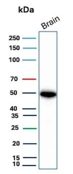 GFAP (Astrocyte and Neural Stem Cell Marker) Antibody in Western Blot (WB)