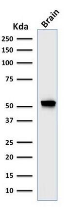 GFAP (Astrocyte and Neural Stem Cell Marker) Antibody in Western Blot (WB)