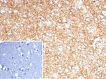 GFAP (Astrocyte and Neural Stem Cell Marker) Recombinant Rabbit Monoclonal Antibody (GFAP/8255R)