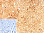GFAP (Astrocyte and Neural Stem Cell Marker) Recombinant Rabbit Monoclonal Antibody (GFAP/8615R)