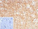 GFAP (Astrocyte and Neural Stem Cell Marker) Recombinant Rabbit Monoclonal Antibody (GFAP/8616R)