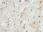 GFAP (Astrocyte and Neural Stem Cell Marker) Antibody in Immunohistochemistry (Paraffin) (IHC (P))