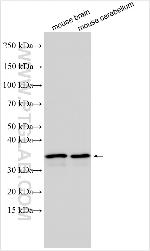 USP54 Antibody in Western Blot (WB)