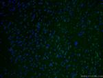 STX5 Antibody in Immunohistochemistry (Paraffin) (IHC (P))