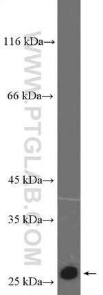 P27/KIP1 Antibody in Western Blot (WB)