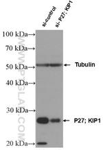 P27/KIP1 Antibody in Western Blot (WB)