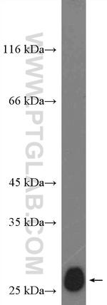 P27/KIP1 Antibody in Western Blot (WB)