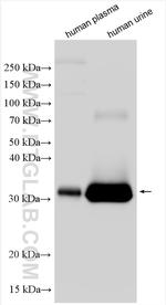 Alpha 1 microglobulin Antibody in Western Blot (WB)