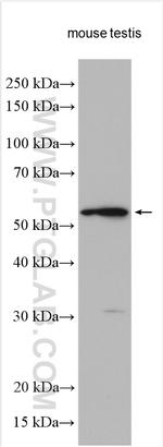 DNAJC3 Antibody in Western Blot (WB)