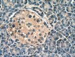 FAM176A Antibody in Immunohistochemistry (Paraffin) (IHC (P))