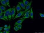 TUFM Antibody in Immunocytochemistry (ICC/IF)