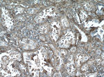 CYBRD1 Antibody in Immunohistochemistry (Paraffin) (IHC (P))