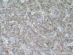 CYBRD1 Antibody in Immunohistochemistry (Paraffin) (IHC (P))
