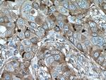 CYBRD1 Antibody in Immunohistochemistry (Paraffin) (IHC (P))