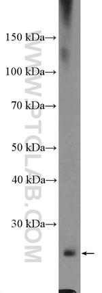 CYBRD1 Antibody in Western Blot (WB)