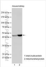 ND4 Antibody in Western Blot (WB)