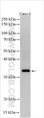GPBAR1 Antibody in Western Blot (WB)