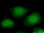 APTX Antibody in Immunocytochemistry (ICC/IF)
