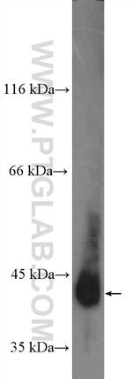 APTX Antibody in Western Blot (WB)