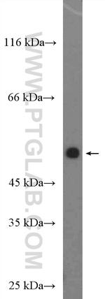 DIRC2 Antibody in Western Blot (WB)