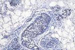 SFRS11 Antibody in Immunohistochemistry (Paraffin) (IHC (P))