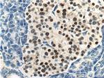 Cyclin D3 Antibody in Immunohistochemistry (Paraffin) (IHC (P))