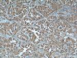 LIF Antibody in Immunohistochemistry (Paraffin) (IHC (P))