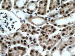 HNRPLL Antibody in Immunohistochemistry (Paraffin) (IHC (P))