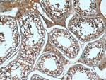 TMBIM6 Antibody in Immunohistochemistry (Paraffin) (IHC (P))