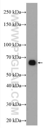 GCGR Antibody in Western Blot (WB)