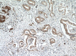 SLC25A12 Antibody in Immunohistochemistry (Paraffin) (IHC (P))