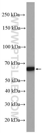 SLC25A12 Antibody in Western Blot (WB)